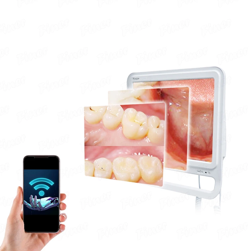 Dental Intra Oral Camera Endoscope with Monitor Dental Intraoral Camera Dental Endoscope