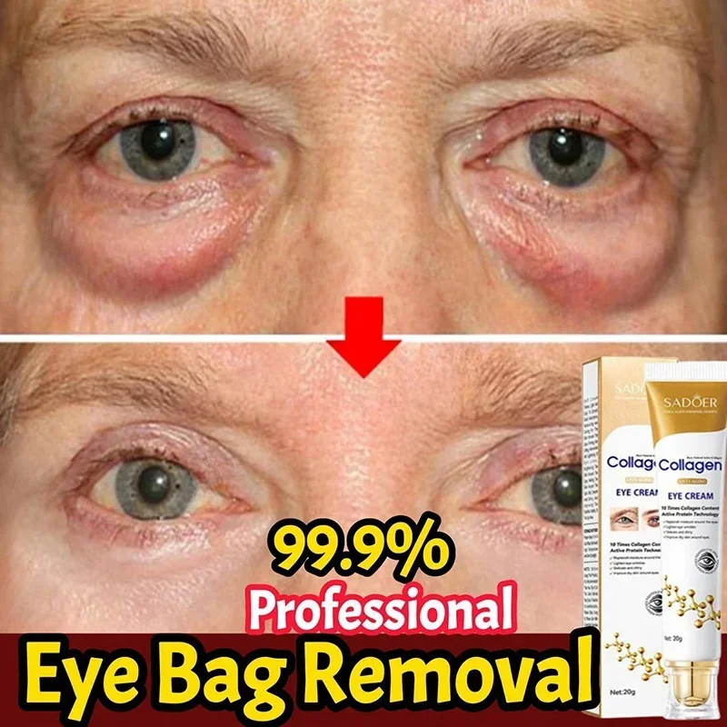 Crema para eliminar bolsas de ojos instantáneas, eliminación de colágeno, arrugas, reafirmante, desvanecimiento de la piel, líneas finas, ilumina las ojeras, antihinchazón, hidrata