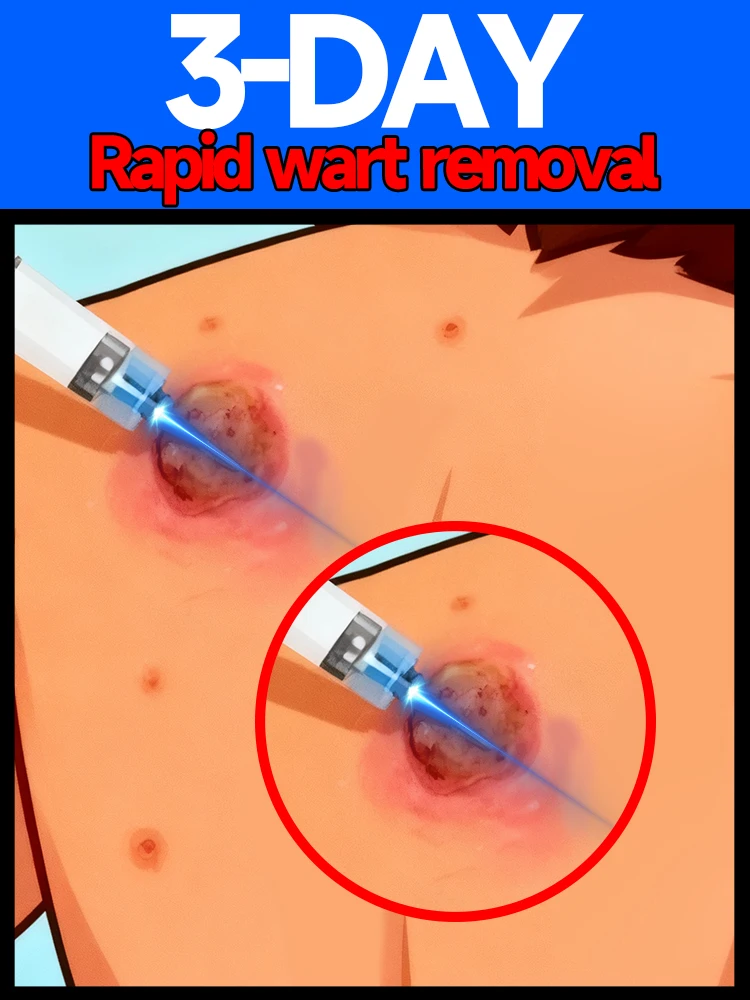 

New formula for 2025, ˢᵃʸ ᵍᵒᵒᵈᵇʸᵉ ᵗᵒ ʷᵃʳᵗˢ ⁱⁿ ⁷ ᵈᵃʸˢ. Skincare tool, visible results in 7 days