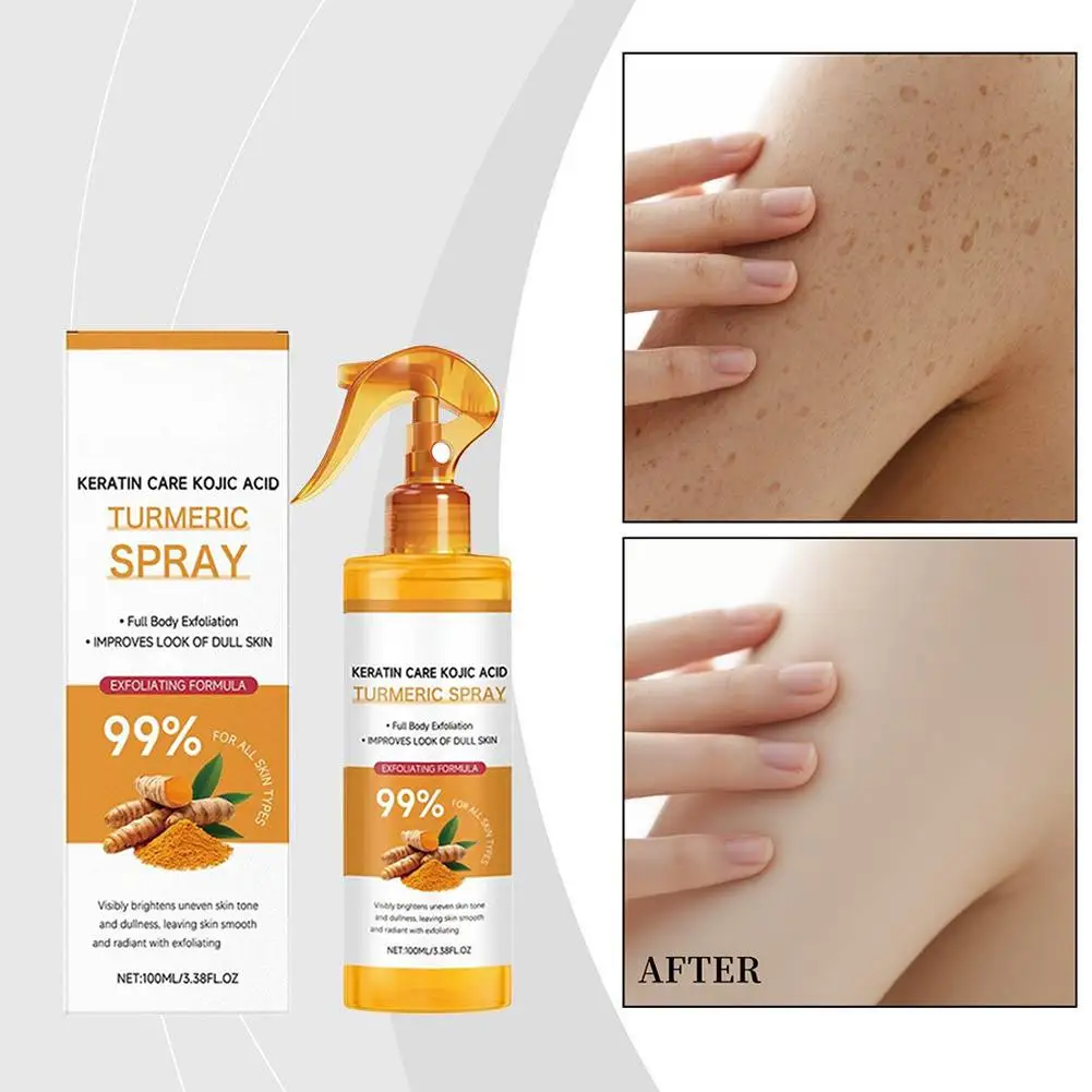 Spray esfoliante alla curcuma all'acido cogico da 100 ml, spray corpo schiarente e esfoliante per la pelle, esfolia e idrata delicatamente