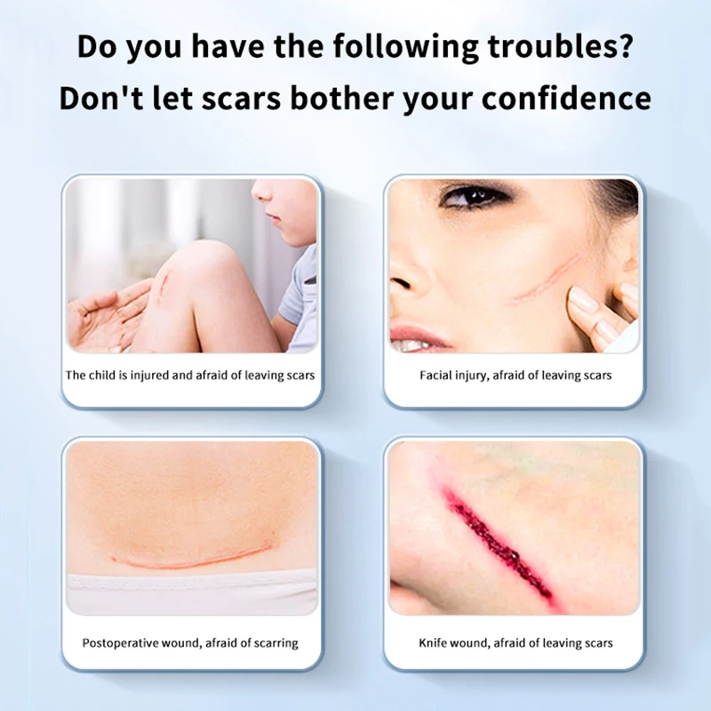 2 قطعة/صندوق سستة التعادل الجرح إغلاق التصحيح حزام مطاط خياطة سريعة مرقئ التصحيح العناية بالبشرة تطهير الفرقة المعونة في الهواء الطلق المحمولة