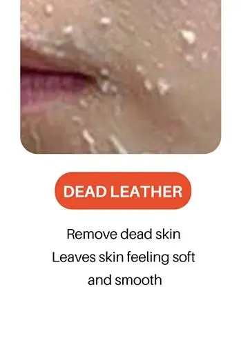 Nieuwe LANTHOME Glutathion Zeep 100 ml Handgemaakte Zeep Essentiële Olie Zeep Kojiczuur Zeep Reinigingszeep Verminderen Dode Huid Mee-eters