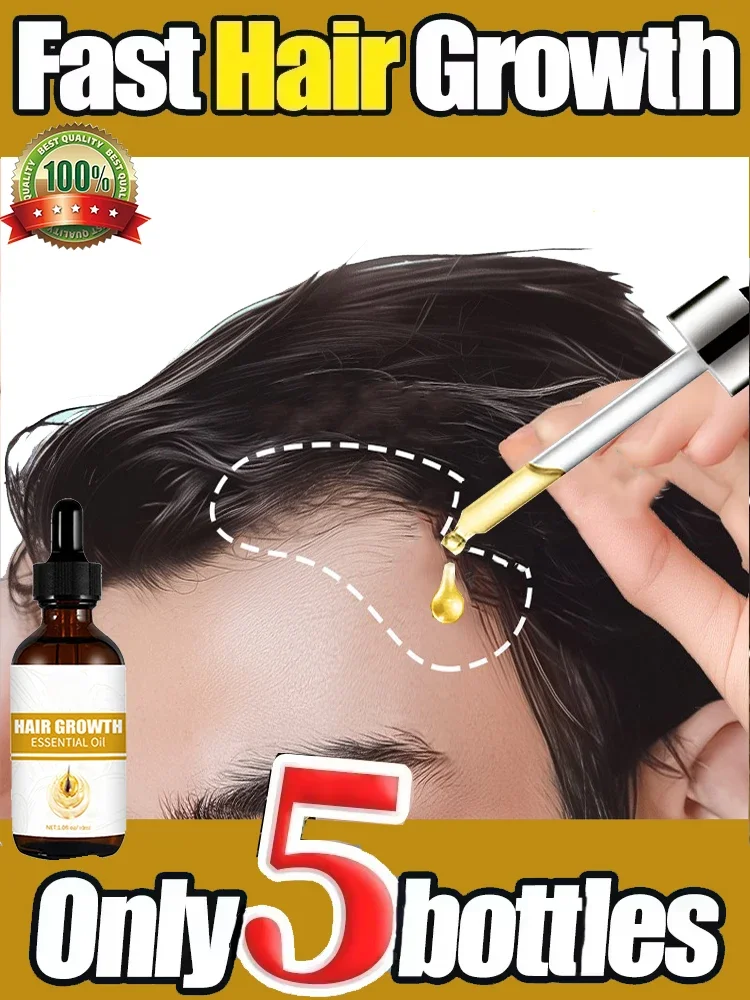 

Effective Fast Hair Growth Serum Baldness Repair Hereditary Postpartum Seborrheic Anti Loss Care for Men Women Scalp Cares8