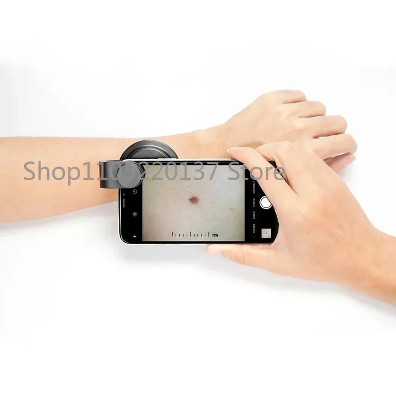 2025 Polarized Optical 10X  Magnifier Smartphone Dermatoscope DE-400 Pocket Round Dermoscopy for Home Use