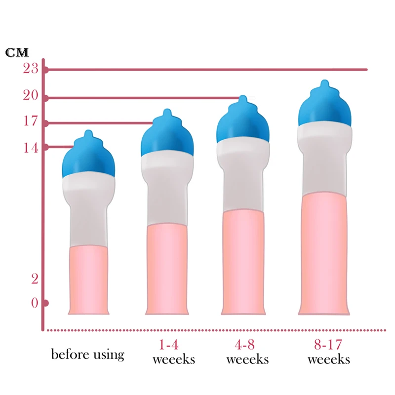 Mannelijke Penis Extender Cock Vergroting Brancard Siliconen Hanger Riem Set Penile Engrotere Enhancement Vacuümpomp Seksspeeltjes Voor Mannen