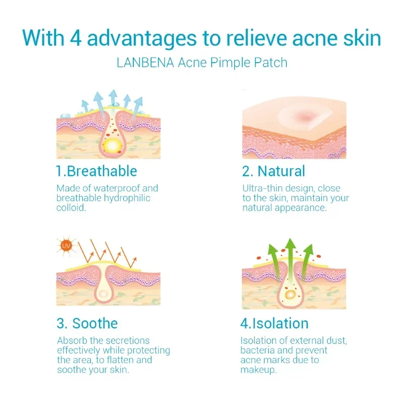 LANBENA Acne Pimple Patch Invisible Acne Stickers Blemish Treatment Acne Master Pimple Remover Beauty Tool Skin Care 28 Patches