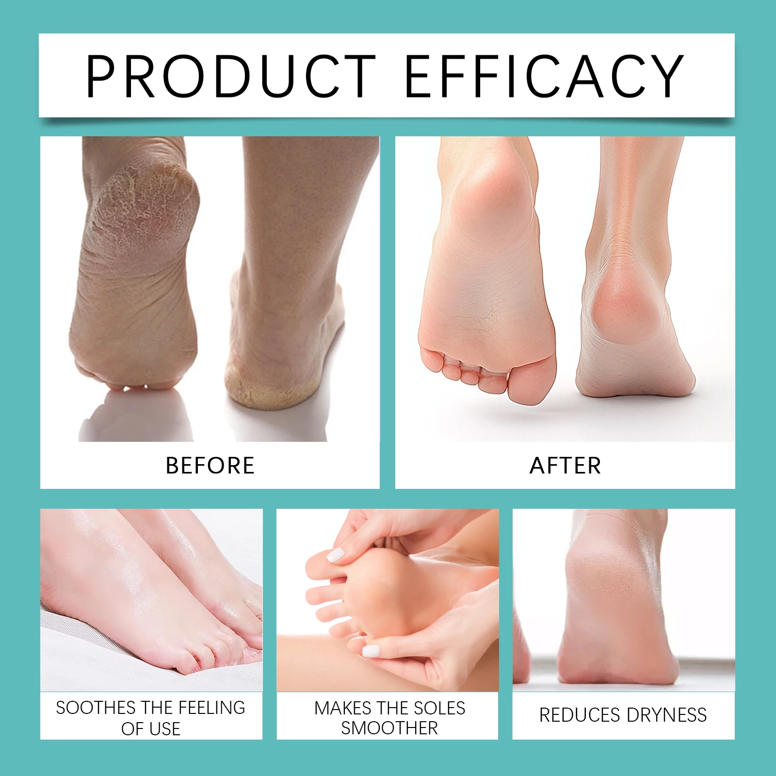 Foot Peeling Spray Instantly Remove Dead Skin Calluses Moisturizing Nourish Dry Cracked Rough Heels Exfoliating Foot Serum 20ml view 3