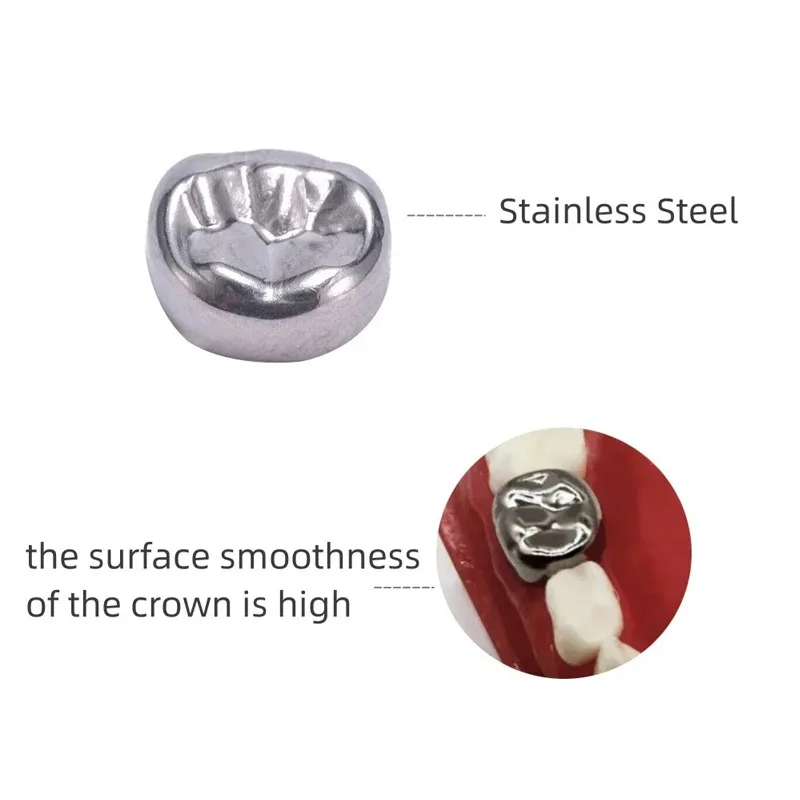 48Pcs/Box Dental Children Deciduous Teeth Stainless Steel Preformed Temporary Crowns Orthodontic Material Teeth Filling Set