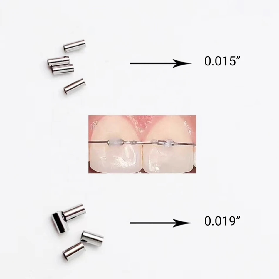 Denxy 50 Stück orthodontische Crimpable Mini Stops Haken-Bracket-Stopper 0,015"/0,019" 2mm RS MEDICO Tube auf Bogendraht Dentalzubehör – Detail 2