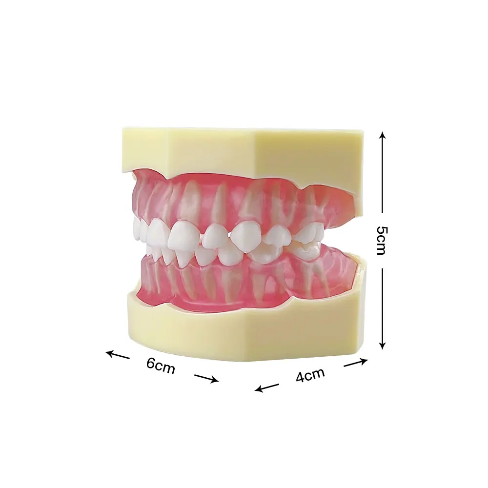 Child Dental Model With Full Mouth Removable Teeth Dentistry Study Teaching Training Typodont Jaw Model Dentistry Lab Products