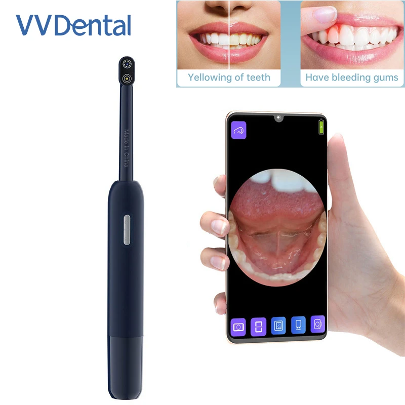 

Visual Intraoral Camera WIFI Oral Examination Camera IP67 Waterproof 1080P Endoscope Cameras 5MP Image System Inspection Tools