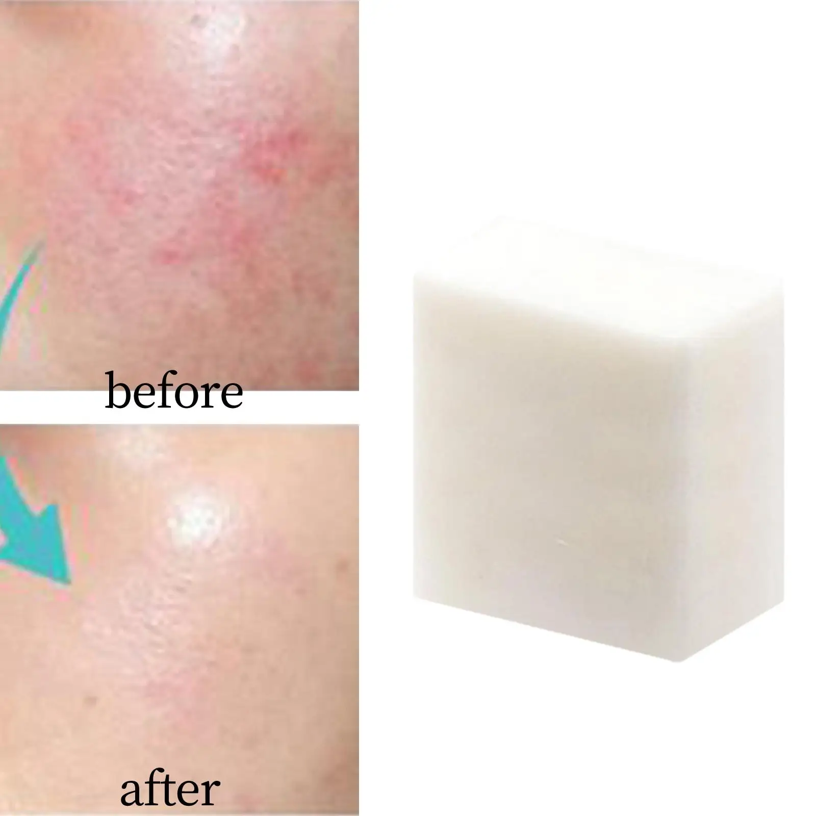 Jabón de proteína 100, Control de aceite, elimina puntos negros, ingredientes naturales, uso en baño, exfoliante hidratante