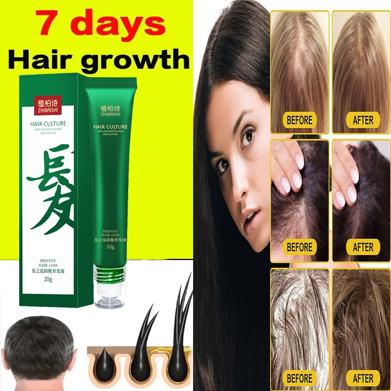 

Fast Hair Growth Oil Effective Baldness Repair Hereditary Hair Loss Postpartum Hair Loss Seborrheic Hair Loss Hair CareTreatment