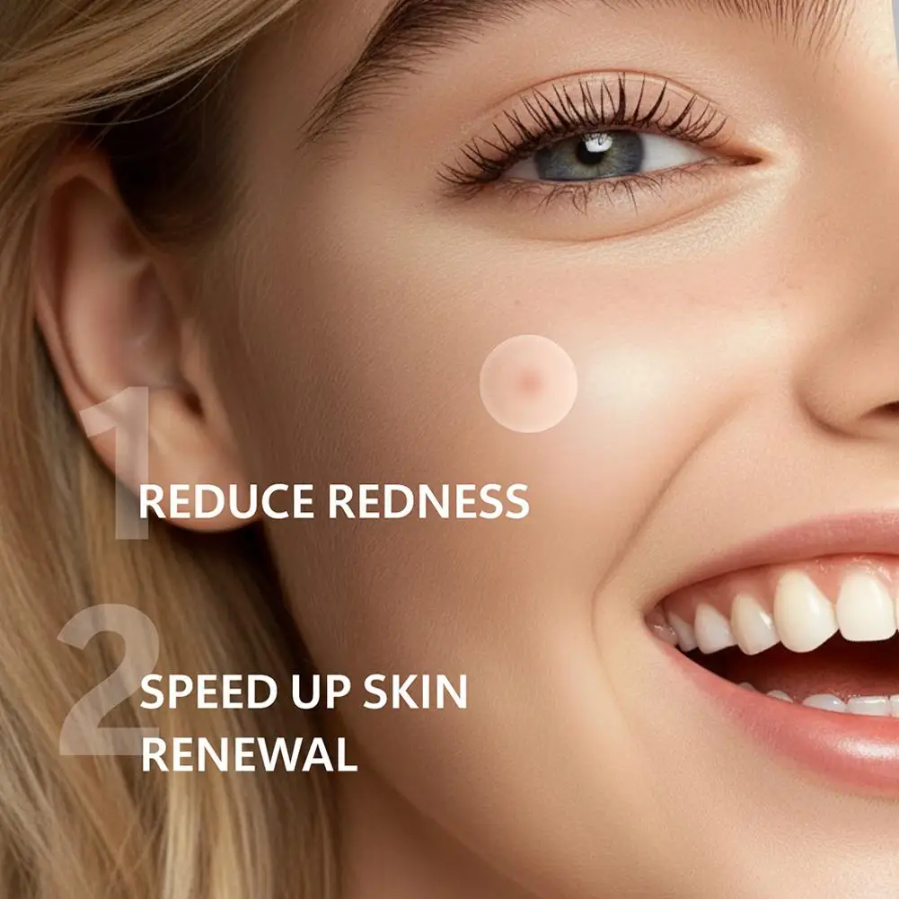 12/24pcs Acne Microneedle Patches For Overnight Use,Hydrocolloid Technology Dissolves Blemishes, Invisible Skin Care 0.2mm