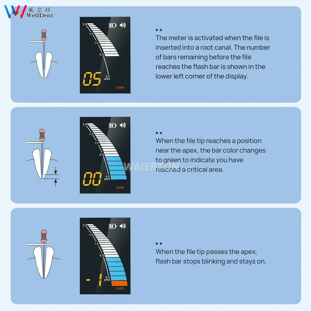 محدد موقع قمة إندو الإلكتروني للأسنان Micropex Pro مناسب لمحرك معدات طب الأسنان اللبية EMS اللبية
