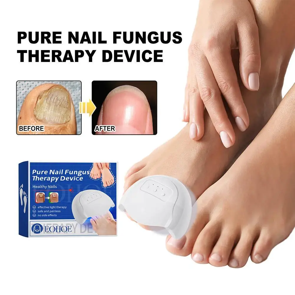 Fungal Nail Laser Device Fast Nails Fungus Repair Onychomycosis Repair Toenail Fingernail Removes Nail Fungus Foot Care Device