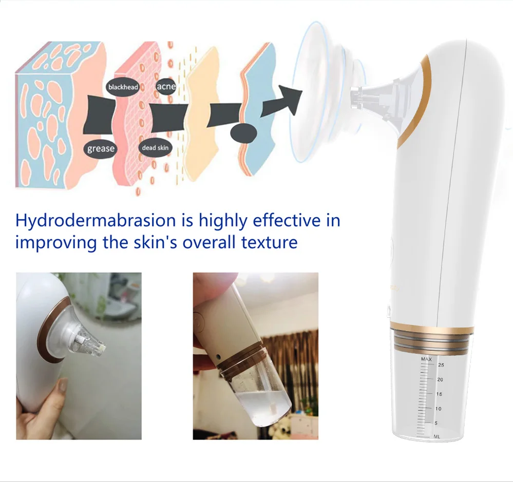 Aspirateur facial pour points noirs, avec aspiration réglable à 3 niveaux, nettoyeur de pores étanche et Kit d'outils de rajeunissement de la peau, nouveau