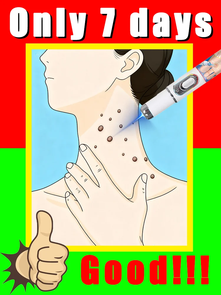 

blue light pen solve warts,unisex,wart care tools,painless,free shipping