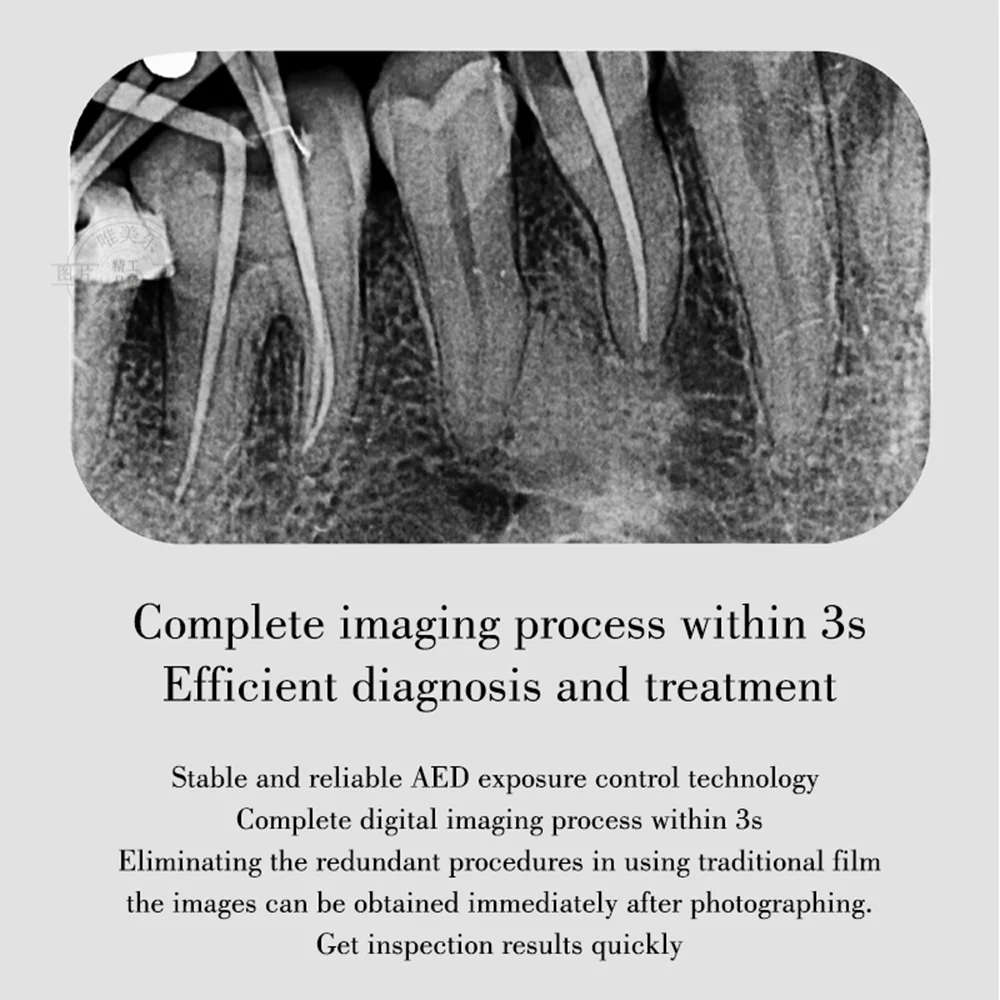 JUMTOP Dental DBA I-Sensor H2 Intraoral X Ray lmaging RVG Sensor with Software High-Frequency X-ray Unit Digital Sensors