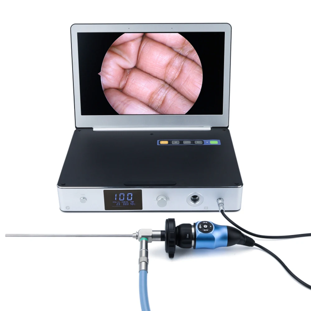 Portable All In One Medical Endoscopy System Full  With 11.6 Inch  And 30W LED Light Source