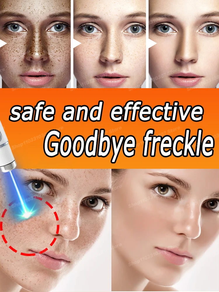 Repair of Facial Dark Spots