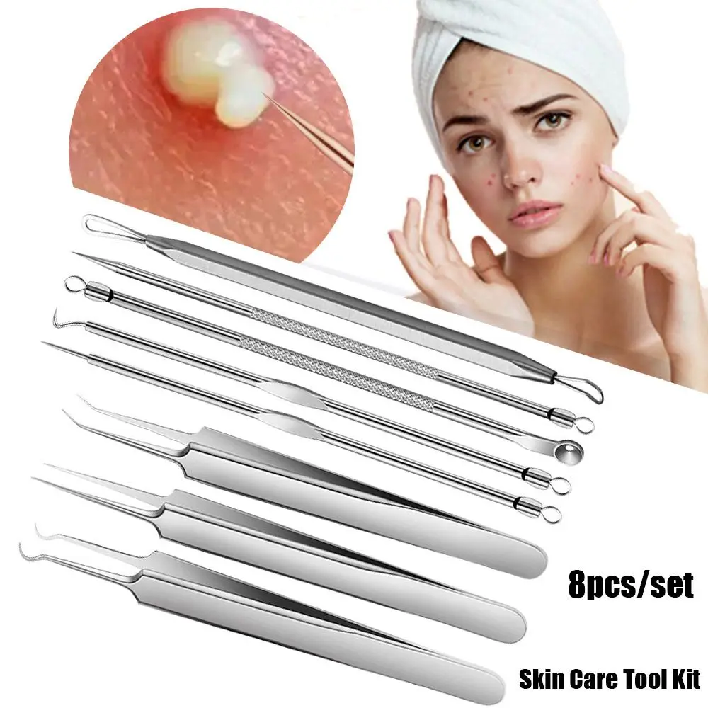 Extrator de poros faciais, pinça, aço inoxidável, ferramenta de cuidados faciais, remoção de espinhas, cravo, kit de ferramentas de cuidados com a pele