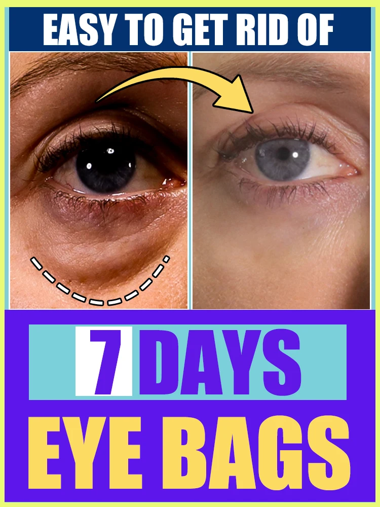 Los alle uw problemen op