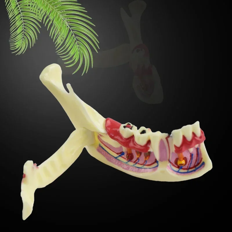 

Dental Endodontic Treatment Model Right Side Anatomy of Gums Study Dental Materials Mandible Tissue Dental Materials