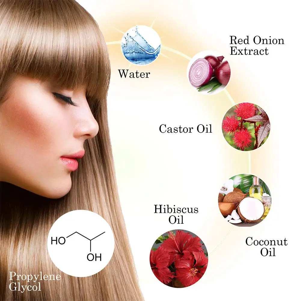 붉은 양파 모발 성장 에센셜 오일 헤어 케어 스프레이 탈모 방지 모발 뿌리에 영양을 공급 모발 질감 향상 헤어 케어 제품