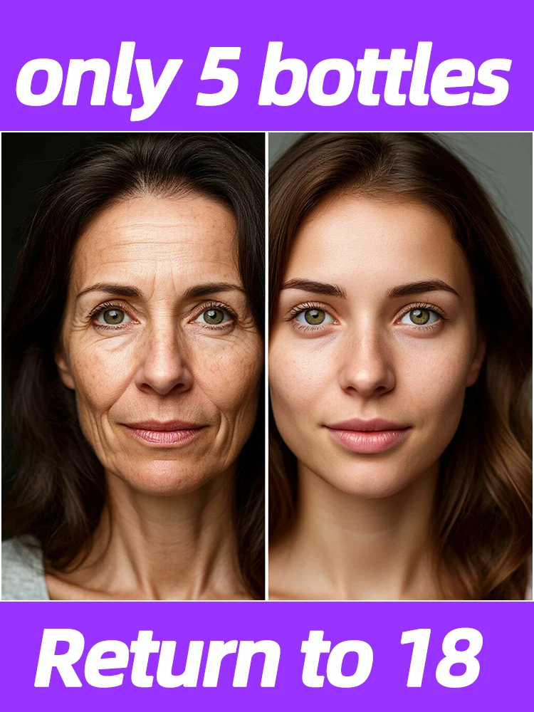 

100% wrinkles disappear，100% younger