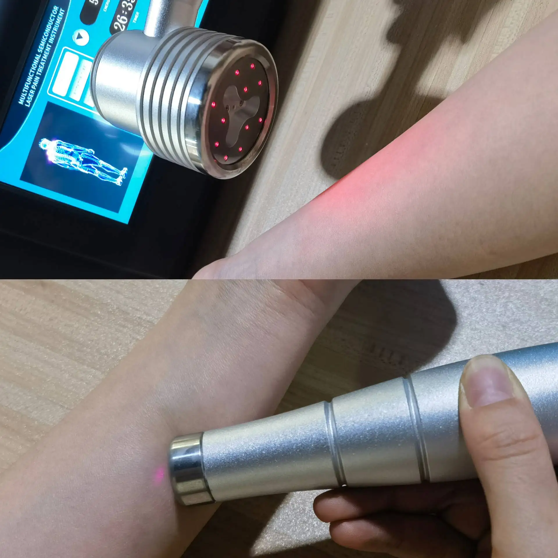 

HLKGO Ветеринарное устройство для холодной лазерной терапии 650 нм 808 нм для облегчения боли в собаках, кошек и лошадей