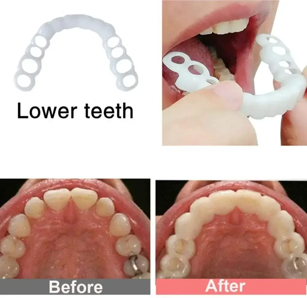 2Pcs Perfect Fit Teeth Whitening Fake Tooth Cover Snap On Silicone Smile Veneers Teeth Upper Beauty Tool