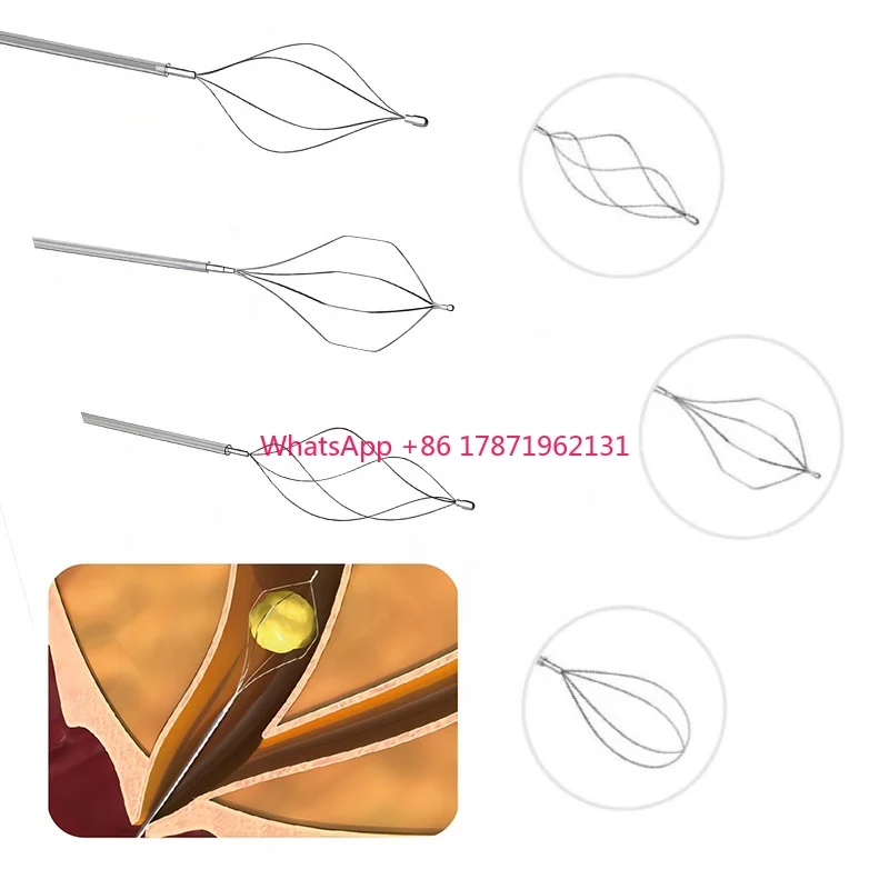 Urology Disposable Stone Extraction Basket Nitinol Basket Stone 1.4/1.8mm Stone Basket