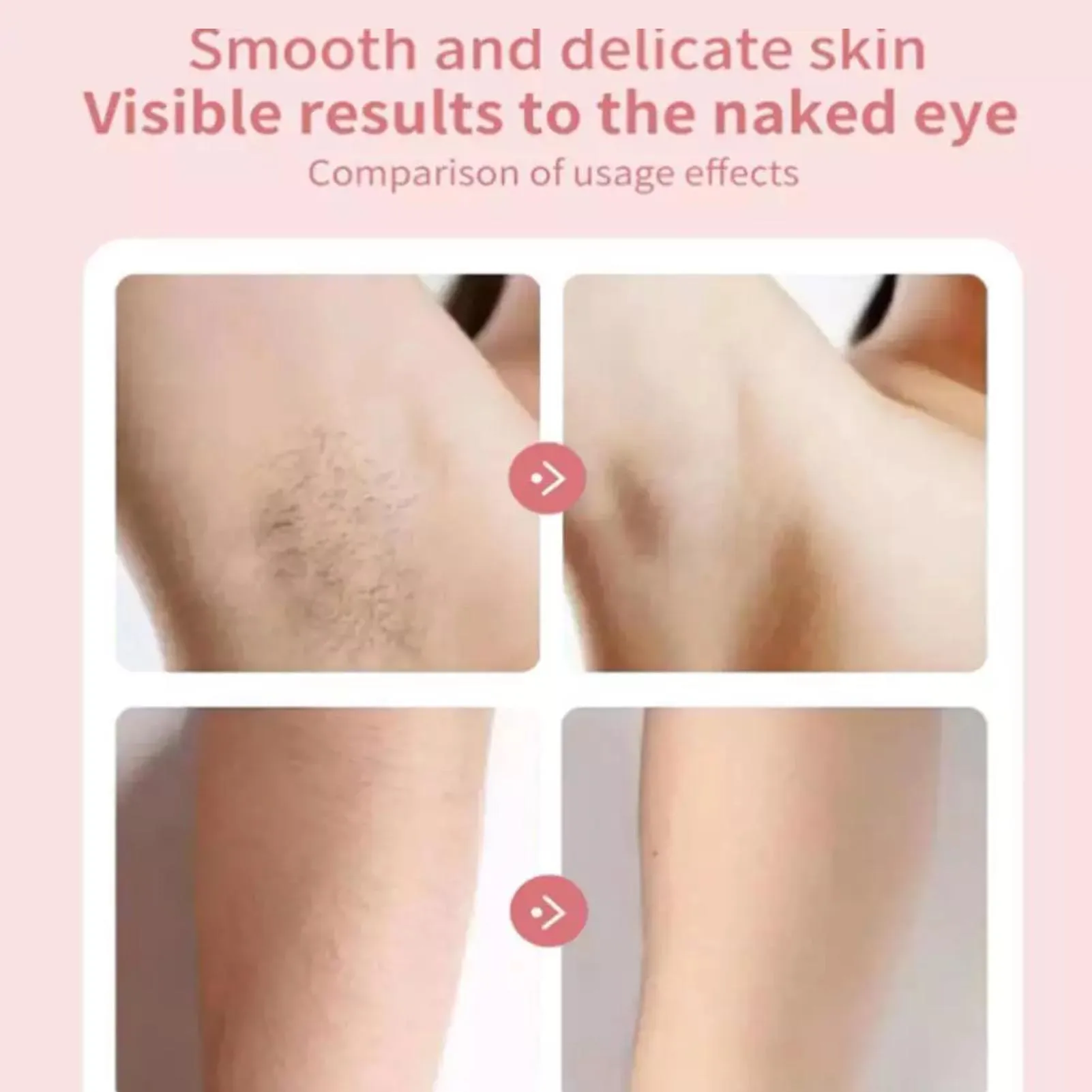 Thumbnail 4 - #30 Popular Depilatories Choices