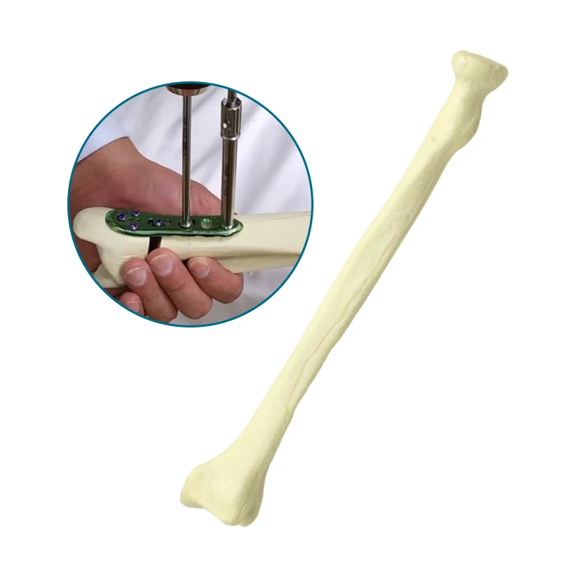 Human Radius Model Radius Practice Drilling Model Medical Teaching Model