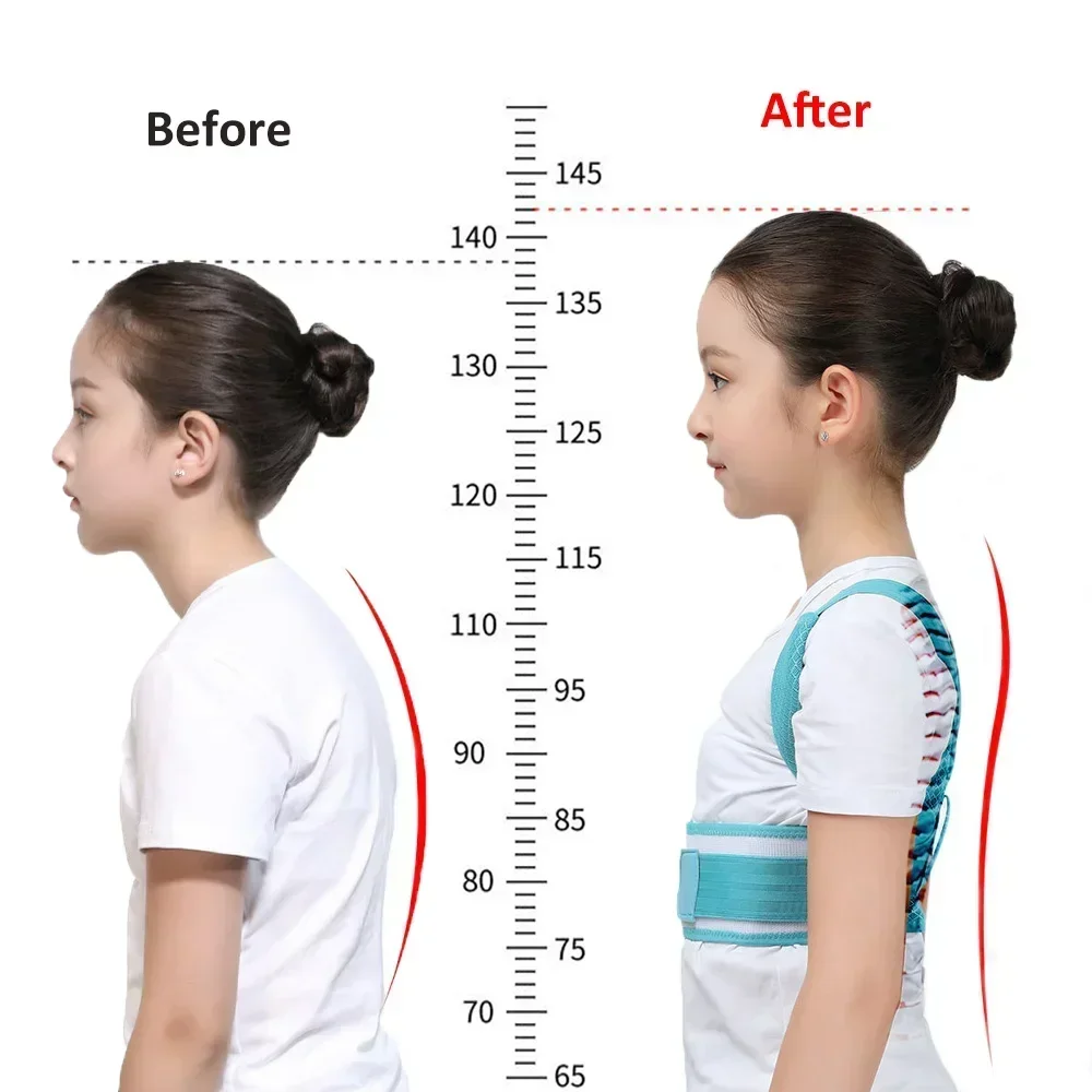 Adjustable Teens Children Posture Corrector Back Support Belt Kids Orthopedic Corset for Spine Back Lumbar Shoulder Braces Belt