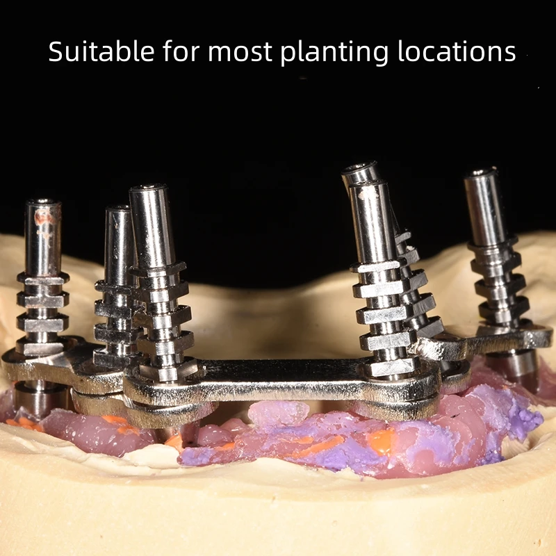 70Pcs All on 4 Dental Prosthesis Metal Implant Supported Overdenture Bar High Quality Stainless Steel All on Four