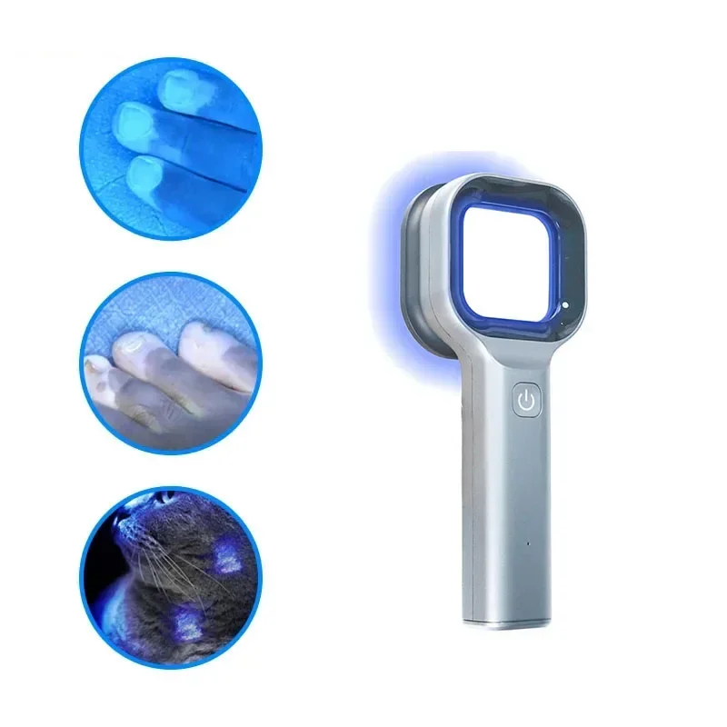 Brand Uv Lamp Woods Lamp For Atopic Dermatitis Analysis