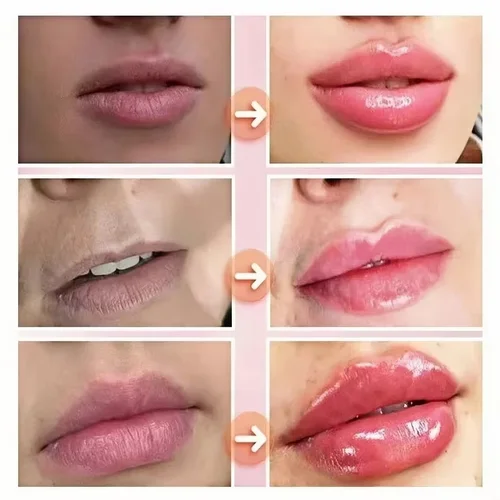 Imagen 2 del producto Aceite esencial de relleno de labios instantáneo, antiarrugas, nutritivo, hidratante, cuidado de labios Sexy, brillo de labios carpante definitivo, suero cosmético