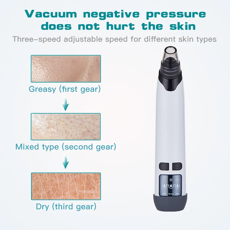 المكتبة الذكية الكهربائية مزيل الرؤوس السوداء آلة إزالة الرؤوس السوداء جهاز إزالة الرؤوس السوداء الأنف مع شفط 4 قطعة #2