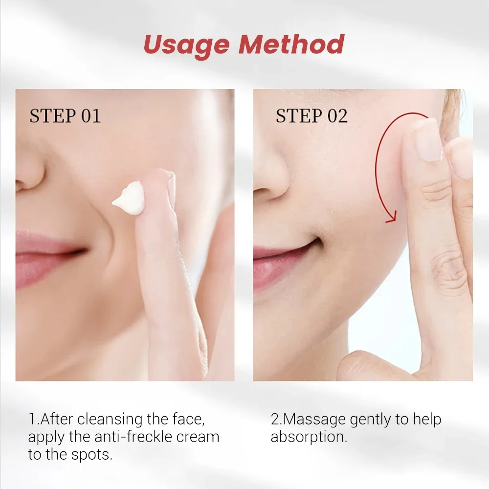 Powerful Whiten Freckle Cream Brighten Face Eliminates Dark Face Spot Melasma Melanin Pigmentation Moisturize Skin Care Cream