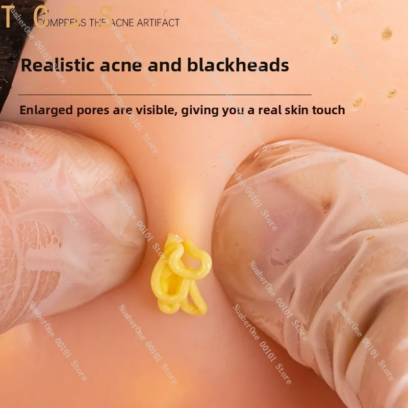 Stress Relief Squeeze Pimple Toy, Simulated Blackhead Acne Nose Model, Fidget Vent Decompression Toy for Anxiety Release