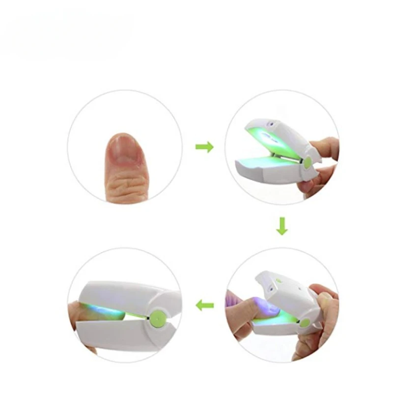 mini portable fungus on feet nails ychomycosis treatment laser