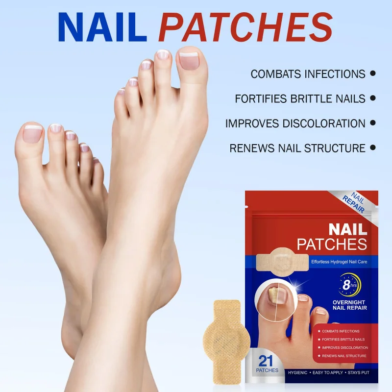 84 Stuks Teennagel Schimmel Patches Waterdichte Nagel Reparatie Patches Nagel Ingegroeide Correctie Stickers Voor Verkleurde Of Beschadigde Nagels