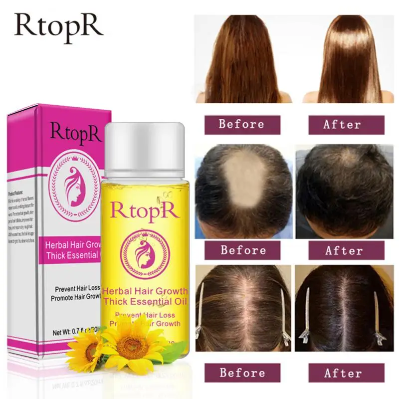 RtopR Hair Oil Prevent Hair Loss Product Hair Growth Essential Oil Easy To Carry Hair Care Nursing Beauty Health Care