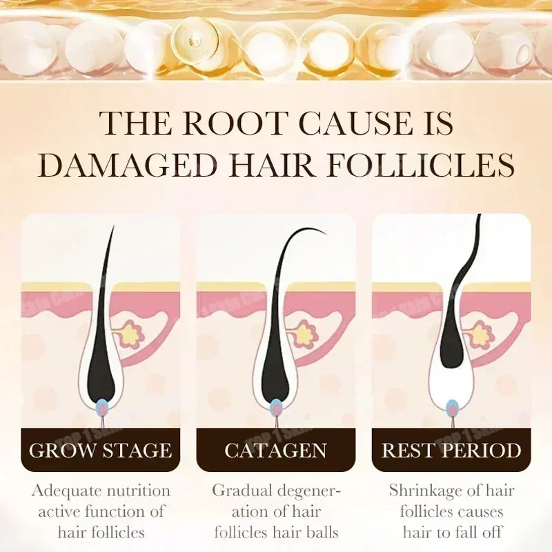 [Official Authentic Product] 99% Repurchase, More and More Hair, Say Goodbye to Baldness, Hot Selling Product