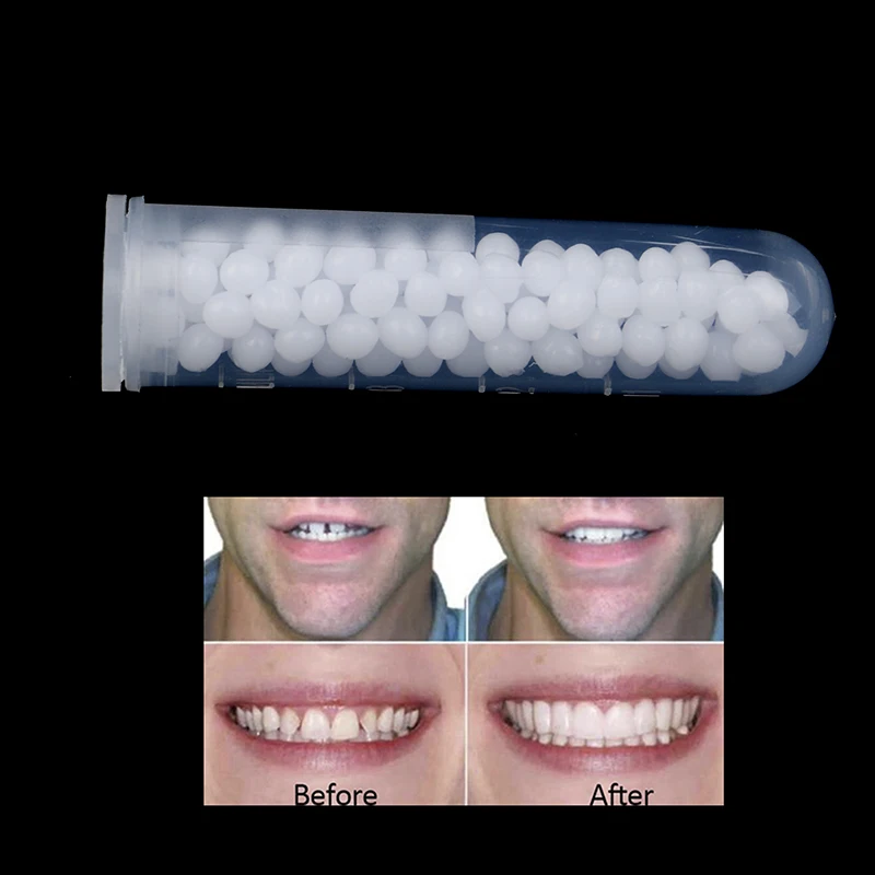 Novo kit de reparo temporário de dentes, dentes e lacunas, cola sólida, adesivo para dentadura, clareamento dos dentes, resina, ferramenta de beleza