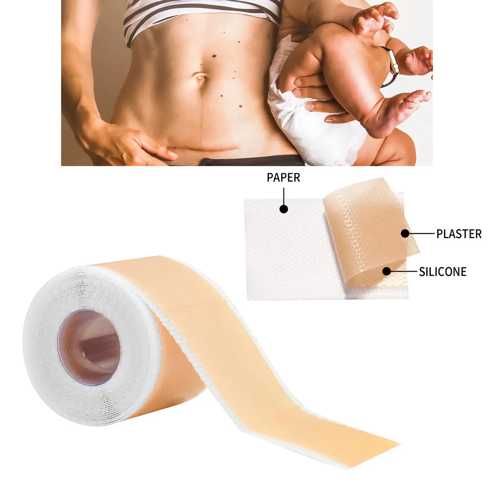 Scars Sheets Treatment Tapes Professional for Keloid Wound Dressing Acne