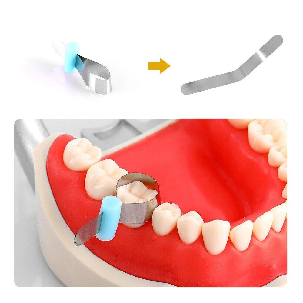 PIORPOY Dentistry Forming Sheet Dental Sectional Contoured Matrix Band Metal Auto Matrices Bands Odontologia Products Dropship - Image 2