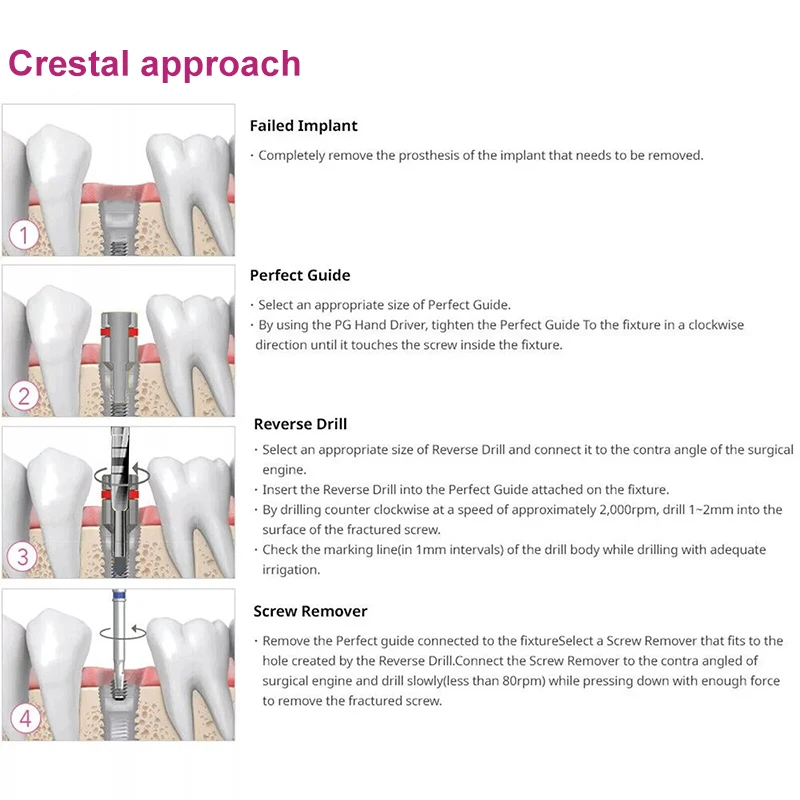 VVDental Dental Implant Fractured Broken Screw Remover Kit Broken Remover Surgery Kit Universal Dentist Tools